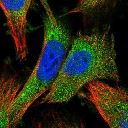 ZNF268 Antibody, Novus Biologicals 25 &mu;L, Unlabeled:Antibodies, Polyclonal